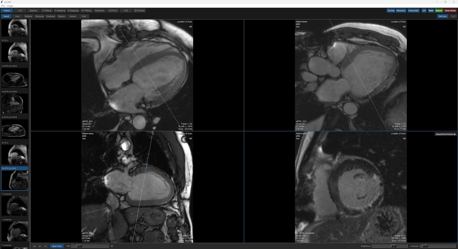 FreeCMR Desktop's Viewer module: a 2x2 layout with Ref Line active, showing where each panel's slice cuts through the others.