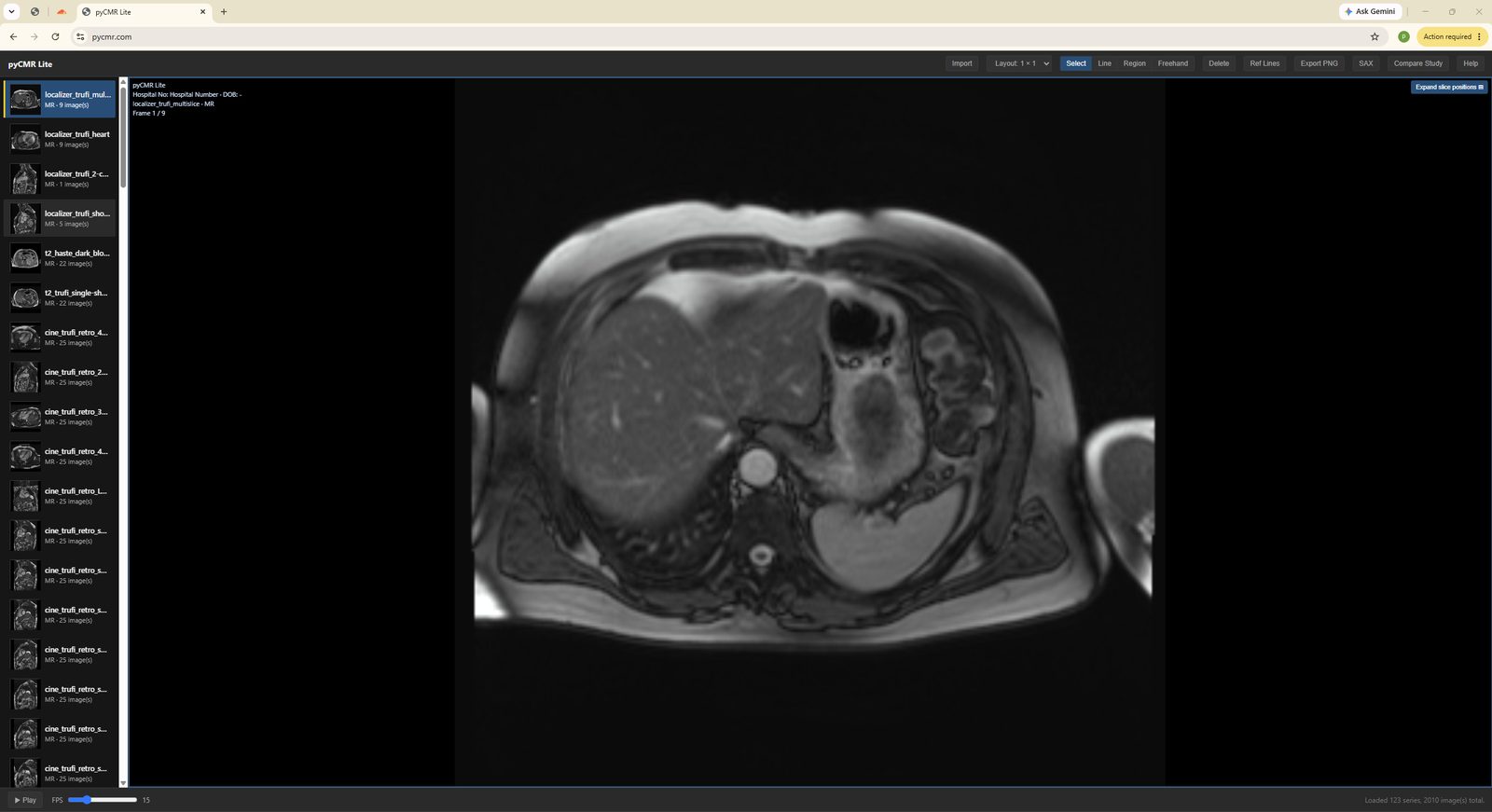 FreeCMR Lite's opening screen after loading a study.